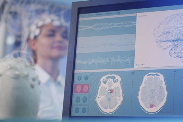 Neuro Electrophysiology